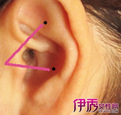 左耳耳廓有痣的女人代表什么 专家大解析命运常识