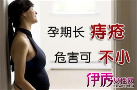 孕妇痔疮怎么治疗方法 孕妇痔疮的症状