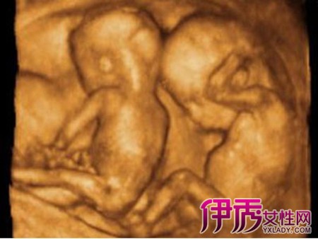 怀孕五个月四维彩超什么样? 图解告诉你胎儿的状况