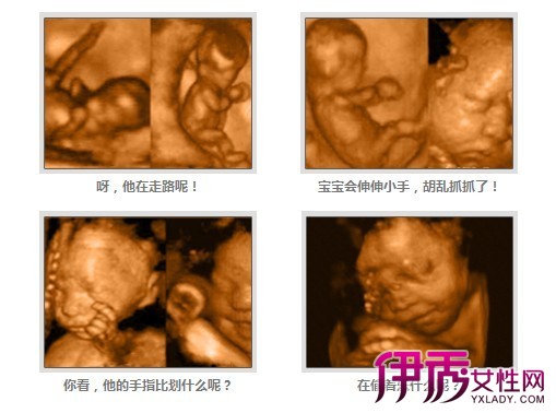 【怀孕九个月胎儿彩超】【图】怀孕九个月胎儿