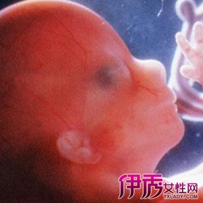 【图】怀孕四个月男女胎儿图展示 孕妈必须谨慎的注意事项