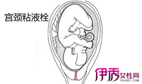 【孕晚期宫颈粘液栓图片】【图】展示孕晚期宫