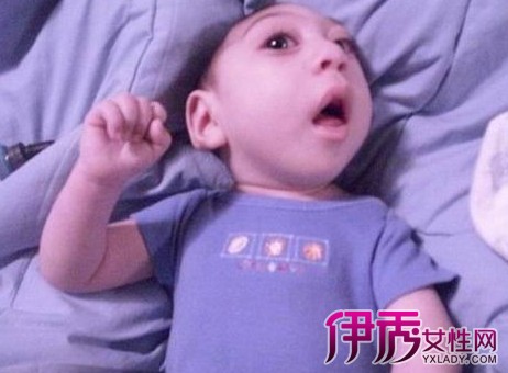 【婴儿痉挛症缩头照片】【图】婴儿痉挛症缩头