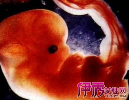 【图】怀孕两个月胎儿图片感觉好神奇 妈妈一定要重视孕期的6件事