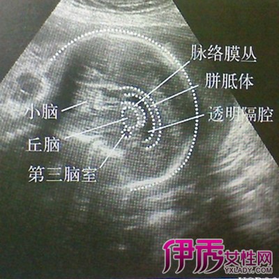 【胎儿超声图解】【图】孕妇怀孕不同周胎儿超