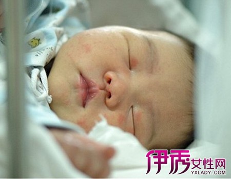 【图】早产儿护理查房图片欣赏教你早产儿护理