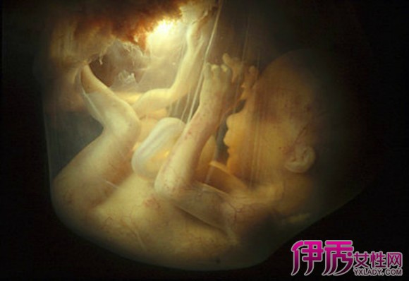 【怀孕左侧睡胎儿图片】【图】怀孕左侧睡胎儿