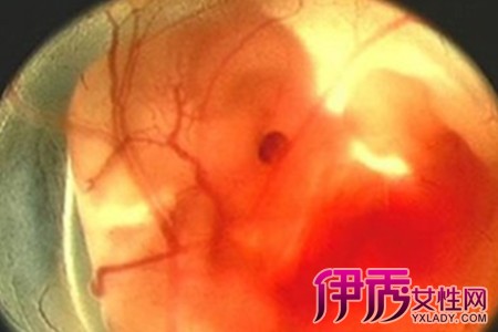 怀孕十二周胎儿发育情况如何? 五方面了解该时期的怀孕症状