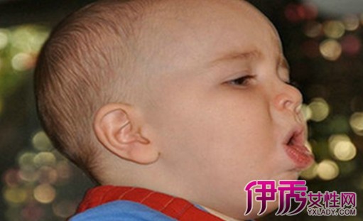 【婴儿急性支气管炎】【图】婴儿急性支气管炎