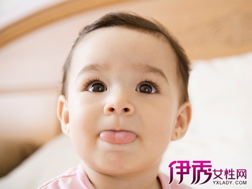 【婴儿脸上有白斑】【图】解答婴儿脸上有白斑