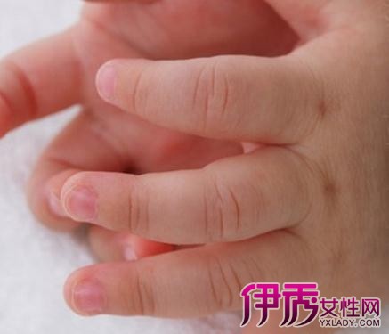 【婴儿的手特别凉怎么回事】【图】婴儿的手特