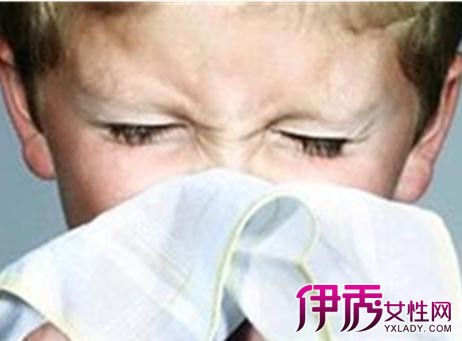 【宝宝过敏性鼻炎会自愈】【图】宝宝过敏性鼻