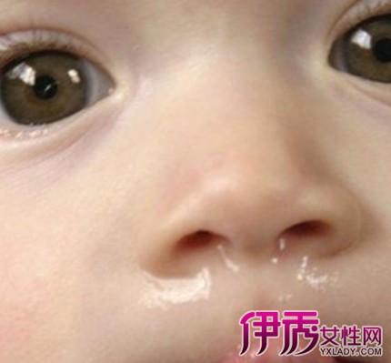 【图】1岁宝宝流鼻涕鼻塞怎么办才好呢妈妈需