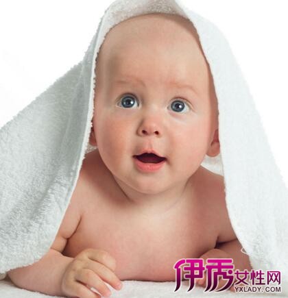 【图】三个月婴儿脸上有白斑怎么办? 父母不得