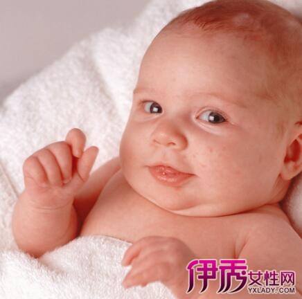 【三个月婴儿脸上有白斑】【图】三个月婴儿脸