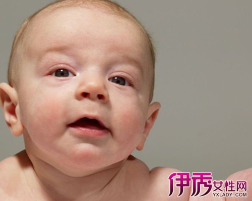 【一岁多宝宝脸上长小红疙瘩】【图】一岁多宝