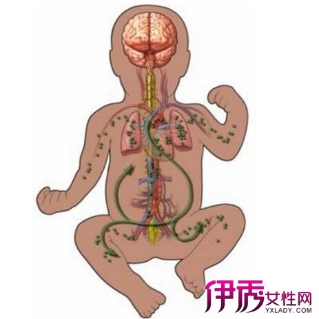 【小儿肠系膜淋巴结炎怎样治疗】【图】小儿肠