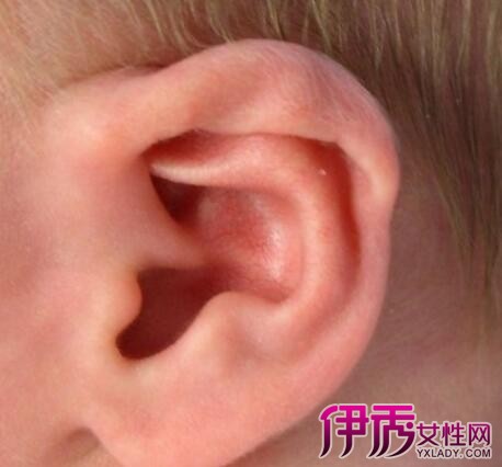【图】九个月的宝宝耳朵长冻疮怎么办 冻疮的3大解决方法