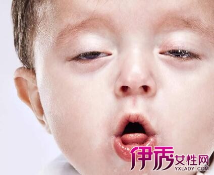【图】两个月大婴儿感冒咳嗽怎么办呢父母应该