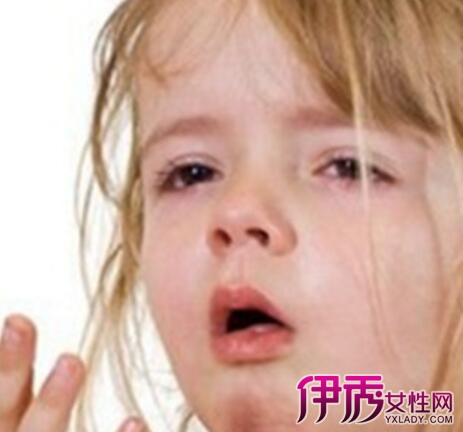 【五岁小孩发烧咳嗽流鼻涕怎么办】【图】五岁