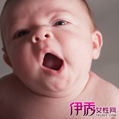 【婴儿口腔溃疡】【图】婴儿口腔溃疡怎么办 