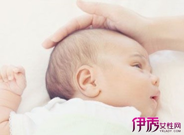 【婴儿额头凹陷】【图】婴儿额头凹陷怎么办?