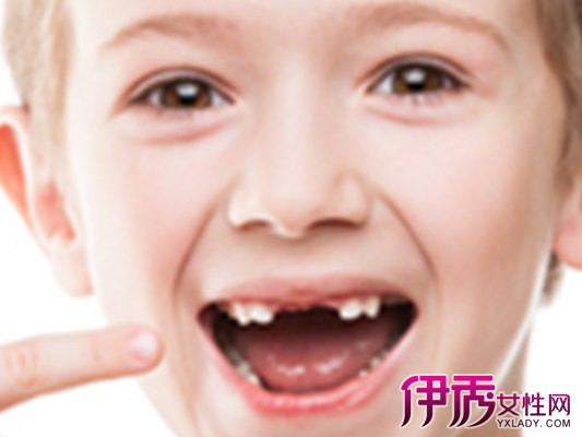 【儿童换牙时间】【图】儿童换牙齿时间是什么