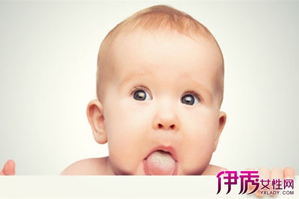 【新生儿舌苔有小白点】【图】新生儿舌苔有小