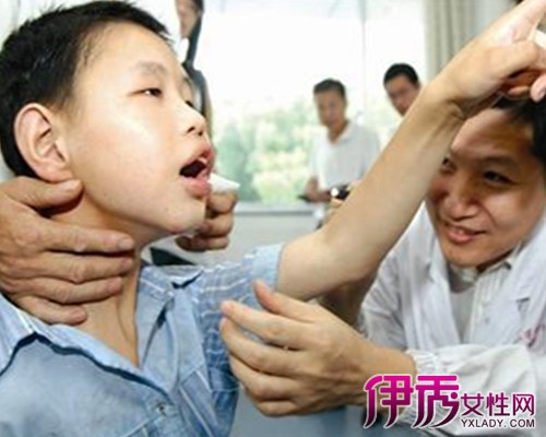 【儿童喉咙发炎】【图】儿童喉咙发炎怎么办 