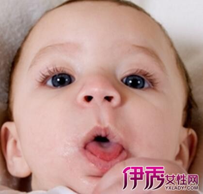 【婴儿脸上湿疹原因】【图】婴儿脸上湿疹原因