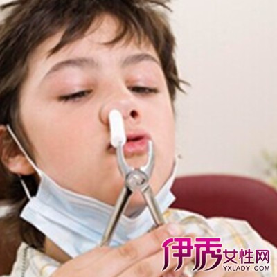 【小孩鼻窦炎症状】【图】小孩鼻窦炎症状有哪