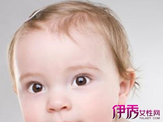 【婴儿头发稀少是什么原因】【图】婴儿头发稀