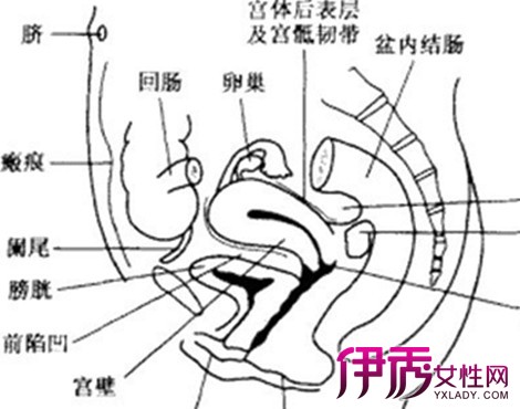 子宫内膜异位症会引起闭经吗 其症状主要表现有哪些