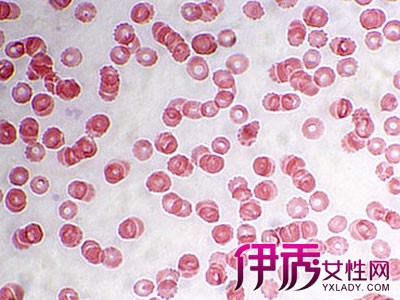 【白细胞和红细胞都偏低是咋回事】【图】白细