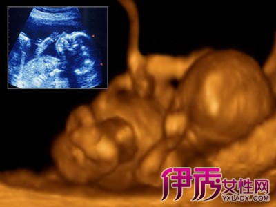 【怀孕婴儿发育过程图】【图】怀孕婴儿发育过