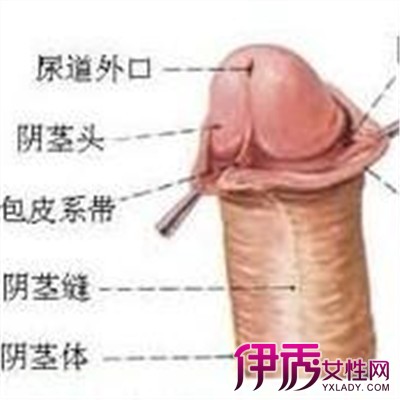 【包茎松解术后遗症】【图】包茎松解术后遗症