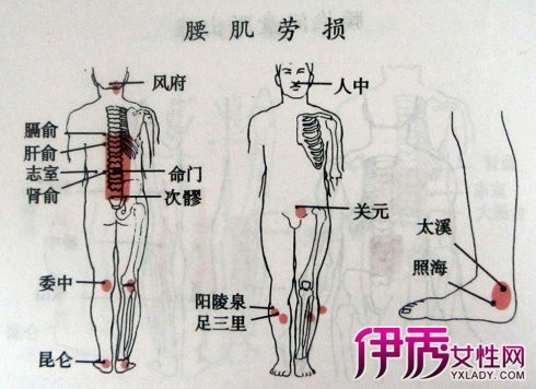 【腰肌劳损的症状】【图】腰肌劳损的症状展示
