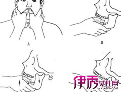 【图】下巴脱臼复位法图解 教你7种方法轻松复位