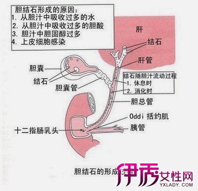 【图】胆管堵塞解密 教你几个诊断小技巧