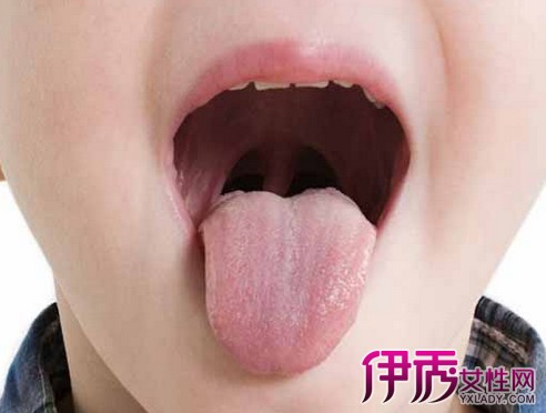 【舌头起泡是什么原因】【图】舌头起泡是什么