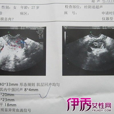 【图】阴超能检查出什么 阴超的七大功能揭晓