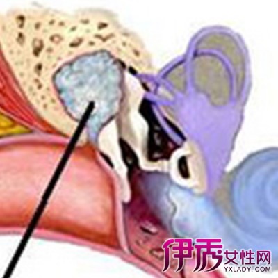 【耳膜炎的症状】【图】耳膜炎的症状是什么?