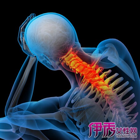 【图】颈椎酸痛怎么办 6招教你摆脱颈椎病