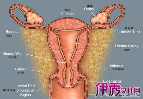 子宫脱垂图片大全 患者可进行子宫托治疗