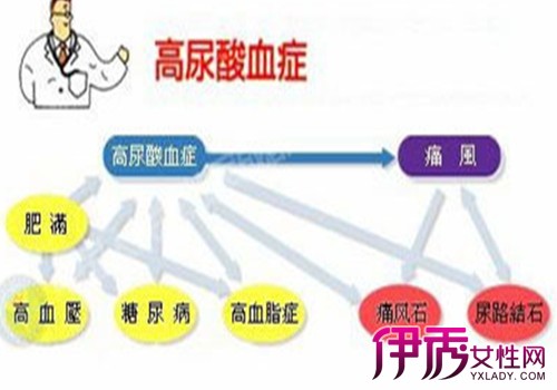 【图】怎么降低尿酸八大方法让你远离高尿酸