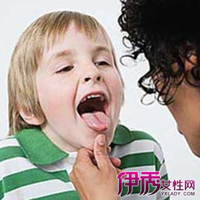 【慢性咽炎是什么】【图】慢性咽炎是什么 盘