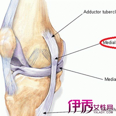 【图】膝关节内侧副韧带断裂图片 几个妙招教你如何治疗该病