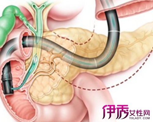 【图】胆管癌晚期死前症状展现 揭秘治疗此病症状的优势