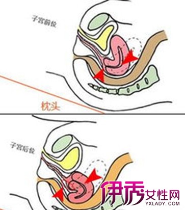 【图】子宫前位是什么意思呢 告诉您3种胎盘位置类型的治疗方法