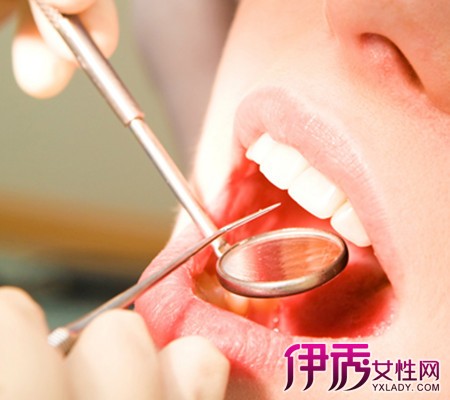 拔牙后1～2天,创口有轻痛属正常现象,若疼痛加剧,则可能有感染